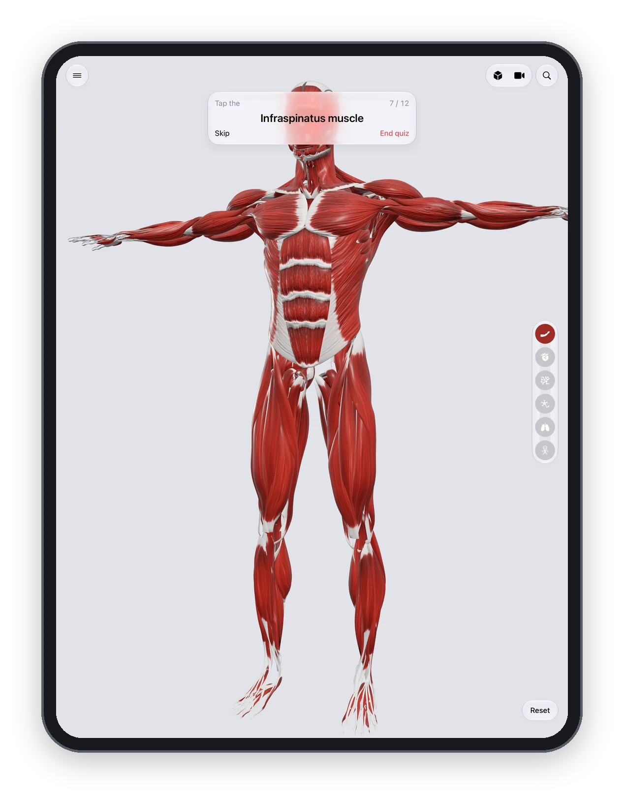 Anatomy Atlas 3D on iPad: the tap-the-structure quiz in progress
